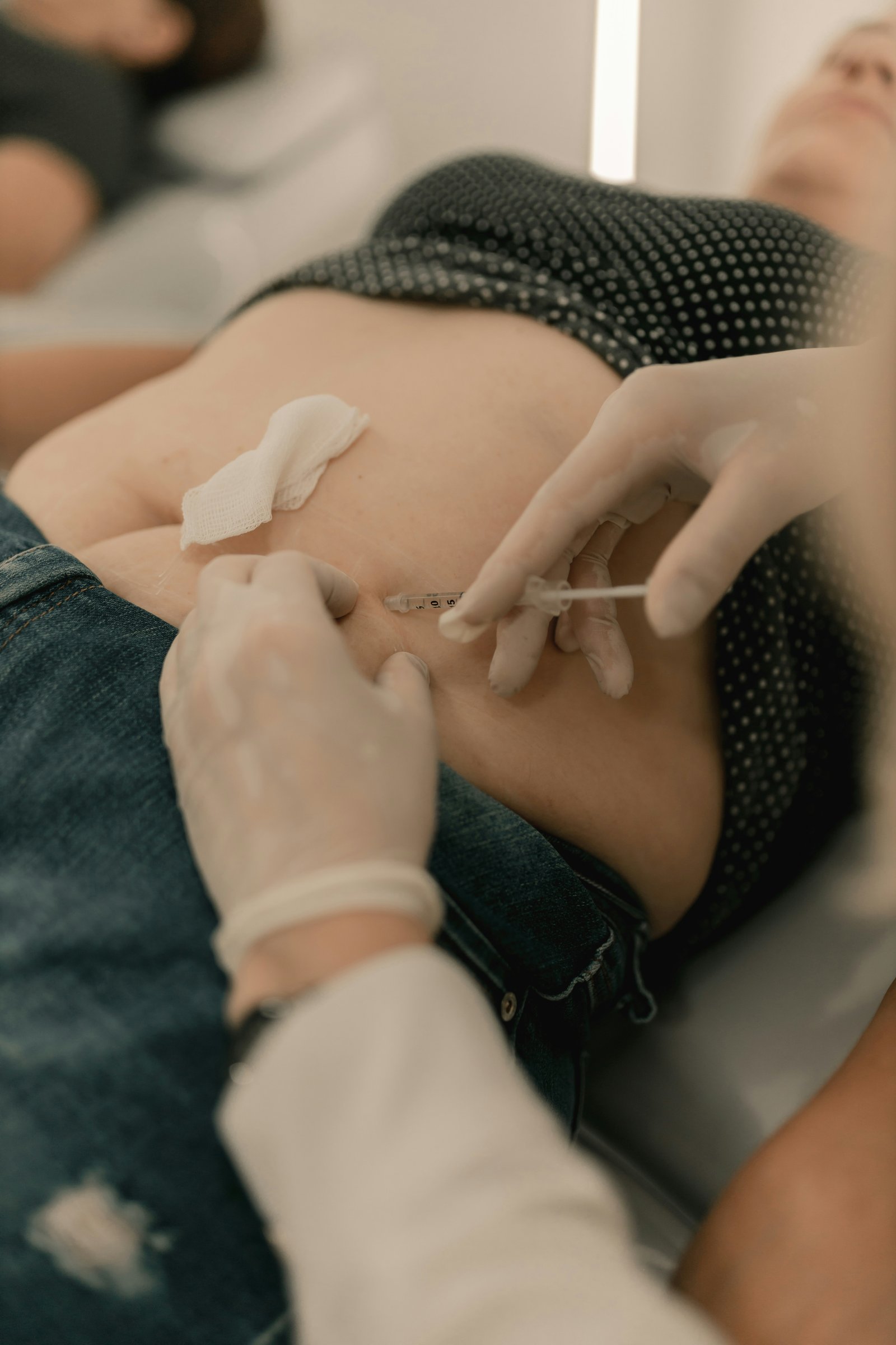 Abdominoplastie
