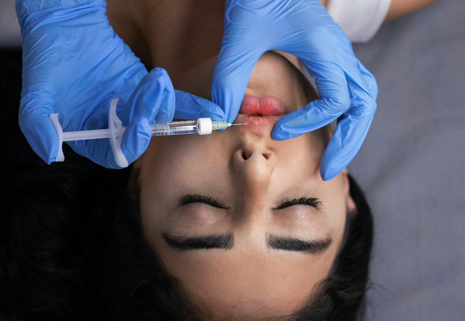 Ablation de lésions cutanées
